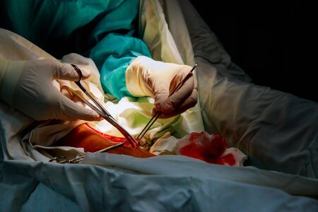 Surgeon using Mayo scissors to cut through tougher tissue in operating room in hospital different surgical tools during the operation close-upの写真素材