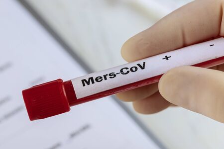 MERS-CoV blood test medical equipment one of several test tubes with MERS virus definitionの写真素材