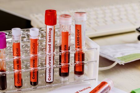 Blood test 2019-nCoV,SARS-CoV, MERS-CoV, medical equipment one of several test tubes with atypical...