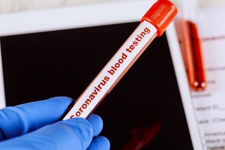 Atypical pneumonia virus blood sample test 2019-nCoV,SARS-CoV, MERS-CoV, 229E, NL63, OC43, HKU1