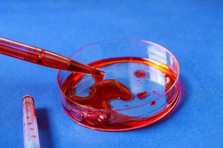 Medical equipment blood test pipette and petri dish in laboratory