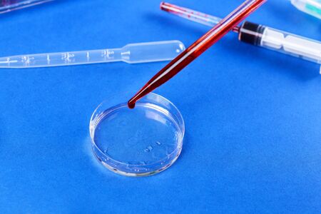 Exam test with pipette and petri dish blood infected virus in medical laboratory blood analysis hospitalの写真素材