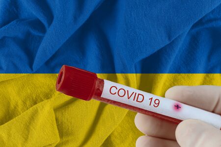 Blood sample with COVID-19 Coronavirus  infection of the Ukraine with test in medical exam laboratoryの写真素材