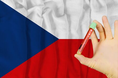 Blood sample with COVID-19 Coronavirus infection of the Czech Republic with test in medical exam laboratoryの写真素材