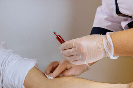 The medicine gloves nurse taking the blood into the test tube, human blood sample
