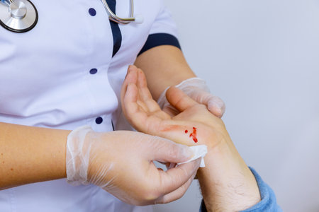 Patient visiting hand injury doctor wipes the blood cleaning a wound