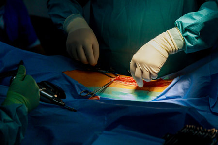 Surgeon makes deep incision with using electrical scalpel pencil to stop the bleeding in surgery of the leg surgeryの写真素材