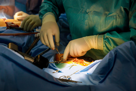 Surgeon makes deep incision with using scalpel to stop the bleeding in surgery of the leg surgeryの写真素材