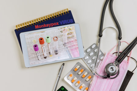 Medical table with infection blood sample test tube for Monkeypox virus phonendoscope, mask and glovesの写真素材