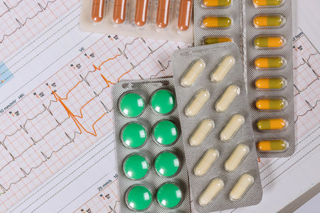 In course of examining cardiogram that doctor has prescribed for heart disease, better pill medication will to follow recommended treatment for heart diseaseの写真素材