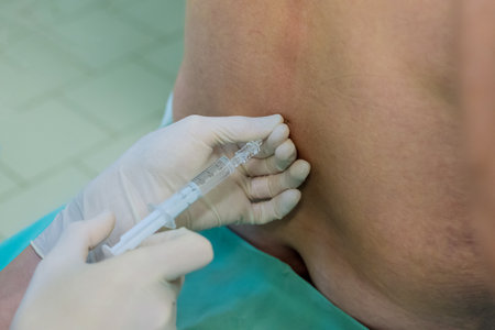 By blocking nerve impulses from reaching brain epidural spinal anesthesia injections enable patient to remain conscious comfortable during surgical procedure.の写真素材