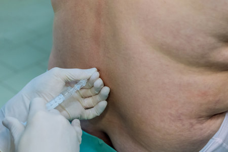 Doctor performs an epidural spinal anesthesia injections during prepare for surgery