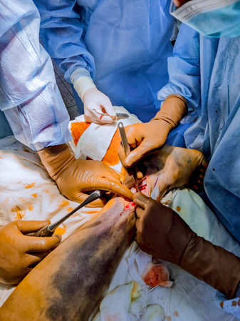 In event of leg fracture, surgeons conduct surgical procedure to install metal plate.の写真素材
