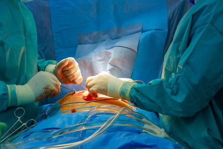 An operating room in hospital is used by medical team of surgeons to perform open heart surgery on patientの写真素材