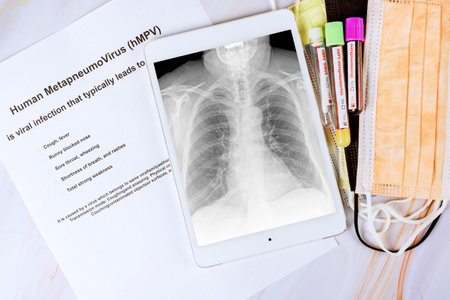 Medical document outlines human metapneumovirus alongside chest x ray, blood samples test tubes in...