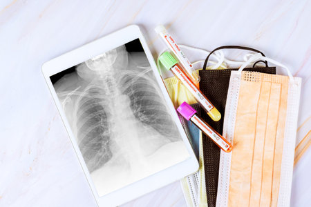 Diagnostic equipment includes chest X-ray alongside protective masks, blood test samples of Human...