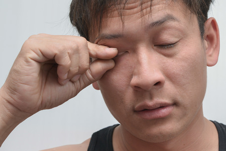 Men have eye irritated And eye inflammation.