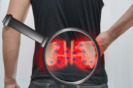 Man pain, kidney infection and kidney pictures.
The concept is easy to understand information about the disease.の写真素材