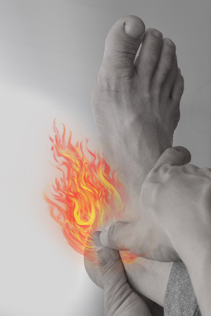 Using fire as a symbol of painful and cancer.Foot pain.の写真素材