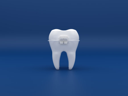 Braces and orthodontics tooth on blue backgroundの写真素材