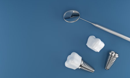 Photo dental implants surgery 3d rendering