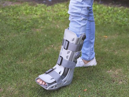 Close up image of a man wearing aircast boot walking on green grass.の写真素材