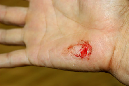 The severe wounds on hands and the blood that had begun to dry.の写真素材