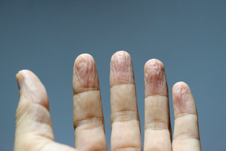 Five fingers that were pale and withered.の写真素材