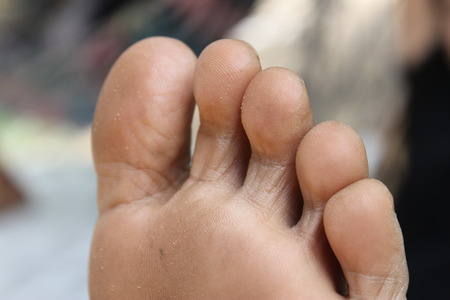Closeup dirty woman toes.