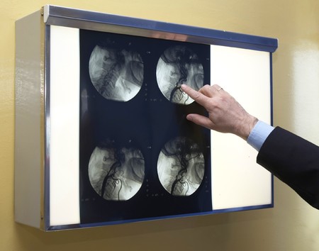 brain x-ray in a x-ray lab exposedの写真素材