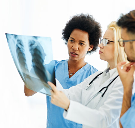 Portrait of a group of doctors looking at a x-ray of lung at meeting in hospital