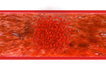 Vascular system - 3d rendered illustration