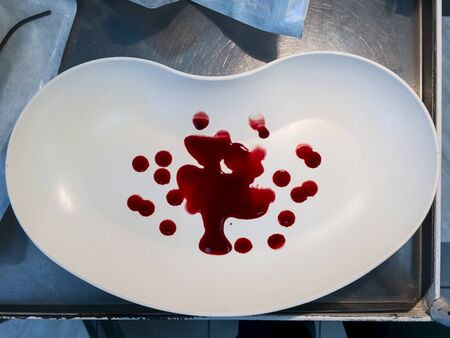 Red blood in the white plastic plate on the surgeric yable amoung intruments. Suitable for any purpose useの写真素材