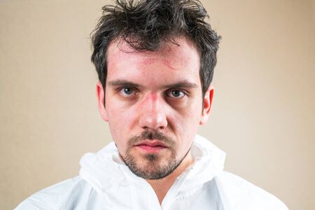 Male doctor wearing white protective suit with wounds from protective respirator after work day...