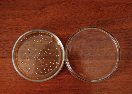 A Petri dish with microbe colonies on a mahogany table. High quality photoの写真素材