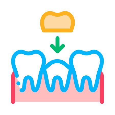 Stomatology Tooth Crown Vector Thin Line Sign Icon. Crown Dentist, Instrument Tool Equipment And Device Linear Pictogram. Medical Treatment Therapy Dentistry Contour Illustrationのイラスト素材