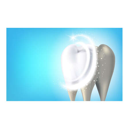Pro Teeth Whitening Creative Promo Banner Vector. Professional Teeth Enamel Whitening, Dental Clinic Medical Occupation Advertising Poster. Whitest Smile Style Concept Template Illustrationのイラスト素材