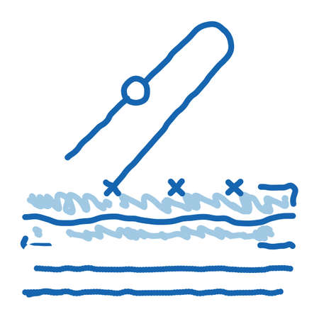 stitching of surgical incision sketch icon vector. Hand drawn blue doodle line art stitching of surgical incision sign. isolated symbol illustrationのイラスト素材
