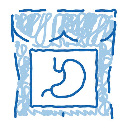 stomach surgery sketch icon vector. Hand drawn blue doodle line art stomach surgery sign. isolated symbol illustrationのイラスト素材
