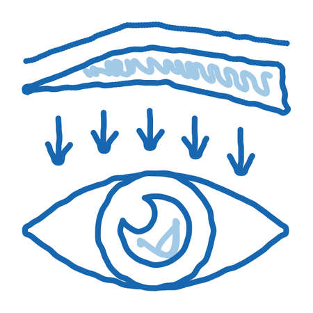 eyebrow down surgery sketch icon vector. Hand drawn blue doodle line art eyebrow down surgery sign. isolated symbol illustrationのイラスト素材