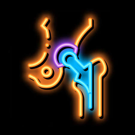 Hip Implant Replacement Biomaterial neon light sign vector. Glowing bright icon transparent symbol illustrationのイラスト素材