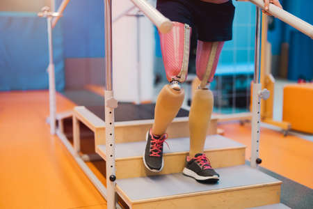 Close up of a woman with prosthetic legs exercising in the gymの写真素材