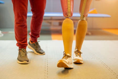 Close-up of a woman walking with prosthetic limbs being assisted by physiotherapistの写真素材
