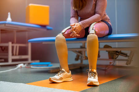 Close up of a woman with prosthetic legsの写真素材