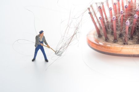 hair loss problemの写真素材