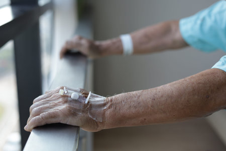 man patient with saline intravenous  on handの写真素材