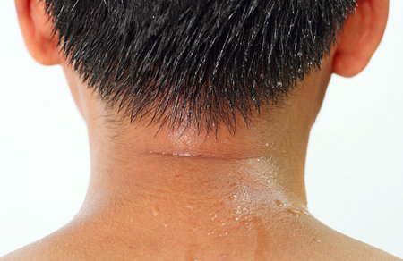 Human Skin and Sweat