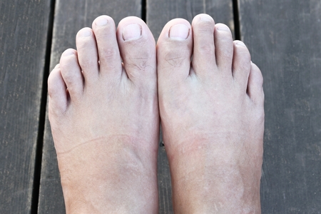 Foot and bacteria.の写真素材