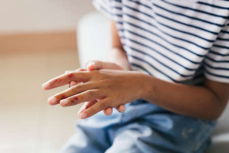 Fresh wound and blood from injured on child fingers after she has been an accident.の写真素材