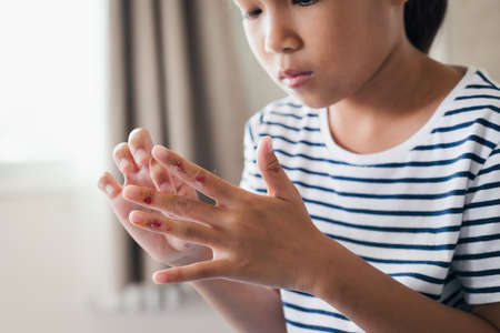 Fresh wound and blood from injured on child fingers after she has been an accident.の写真素材